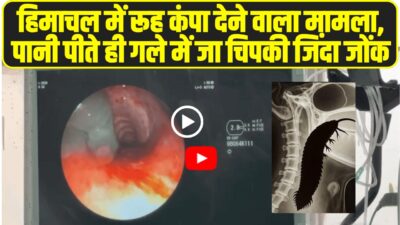 IGMC Shimla latest medical news